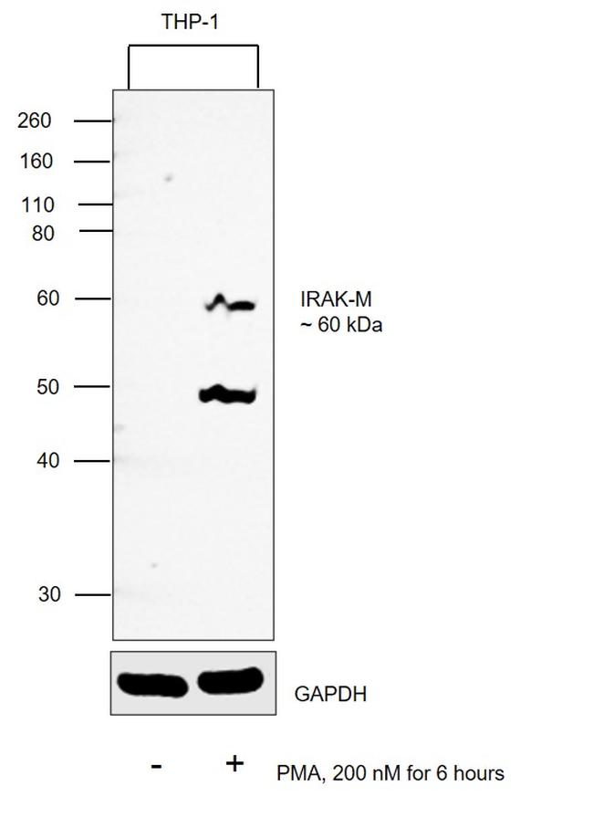 IRAK-M Antibody in Western Blot (WB)