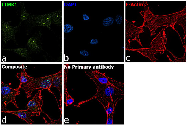 LIMK1 Antibody in Immunocytochemistry (ICC/IF)