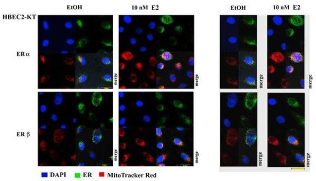 Estrogen Receptor beta Antibody in Immunocytochemistry (ICC/IF)