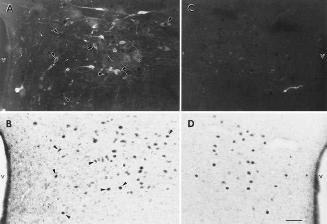 Estrogen Receptor beta Antibody in Immunocytochemistry (ICC/IF)