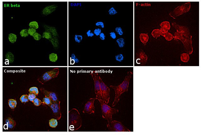 Estrogen Receptor beta Antibody in Immunocytochemistry (ICC/IF)