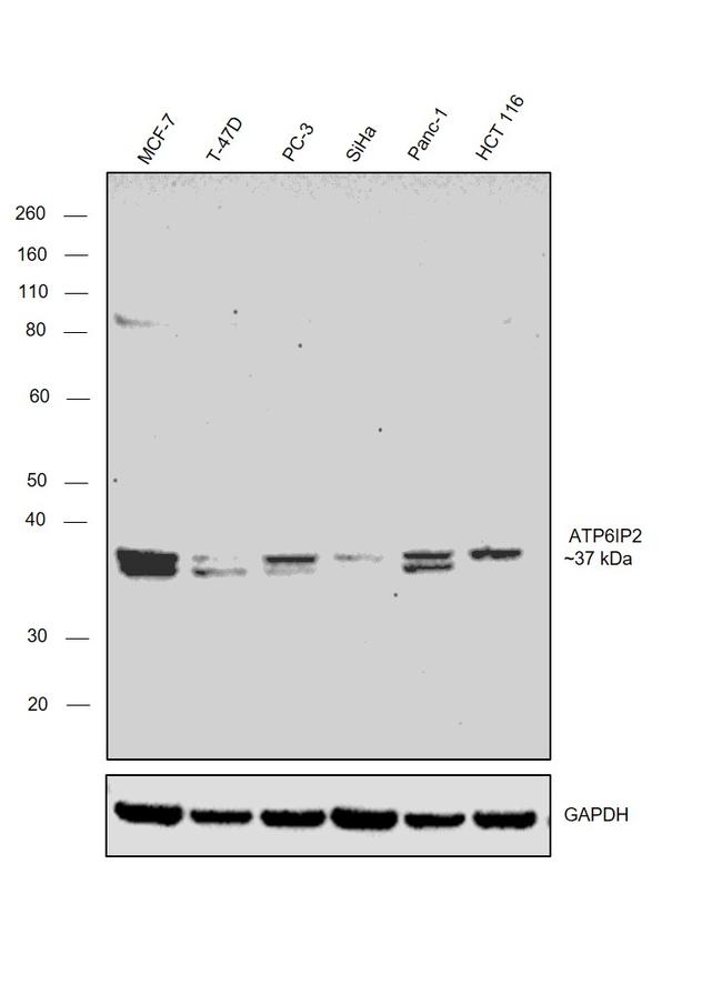 ATP6IP2 Antibody in Western Blot (WB)