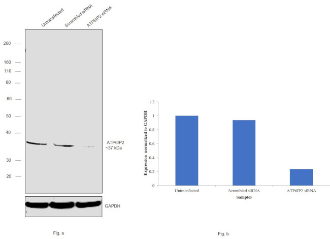 ATP6IP2 Antibody