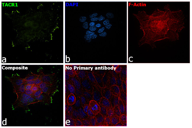 TACR1 Antibody in Immunocytochemistry (ICC/IF)