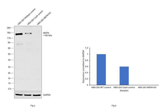 NEFM Antibody in Western Blot (WB)