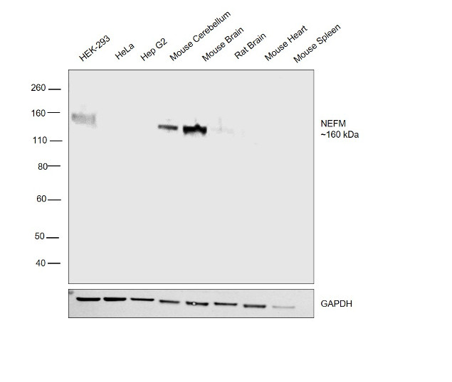 NEFM Antibody