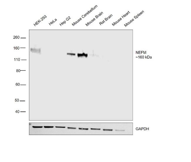 NEFM Antibody in Western Blot (WB)