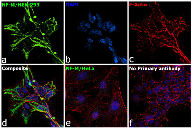 NEFM Antibody in Immunocytochemistry (ICC/IF)