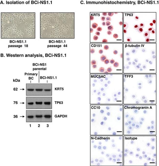 Cytokeratin 5 Antibody in Western Blot (WB)