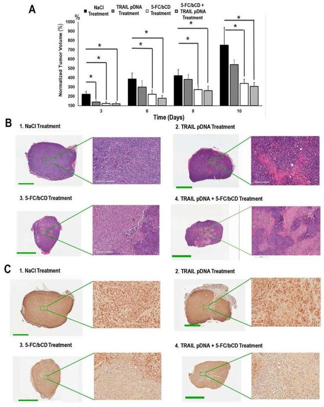 Ki-67 Antibody in Immunohistochemistry (IHC)