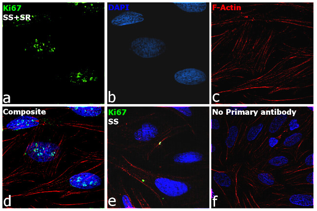 Ki-67 Antibody in Immunocytochemistry (ICC/IF)