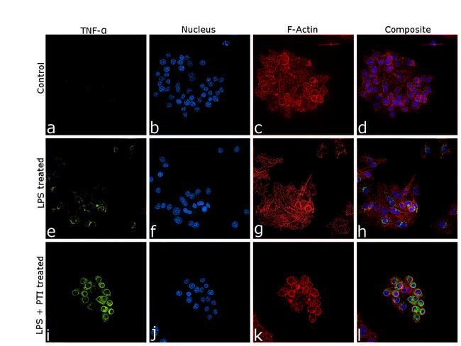 TNF alpha Antibody