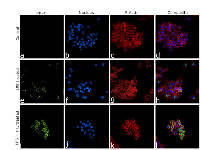 TNF alpha Antibody in Immunocytochemistry (ICC/IF)