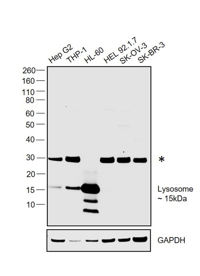 Lysozyme Antibody in Western Blot (WB)