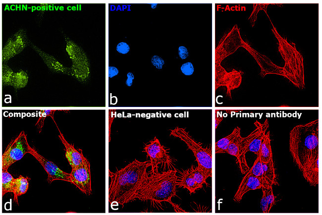 TIM-1 Antibody in Immunocytochemistry (ICC/IF)