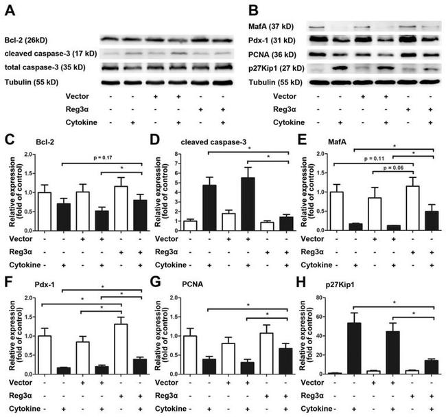 beta Tubulin Antibody in Western Blot (WB)