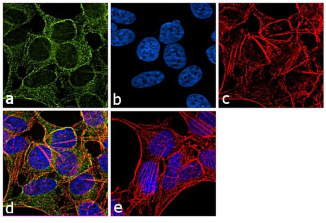 beta Tubulin Antibody in Immunocytochemistry (ICC/IF)