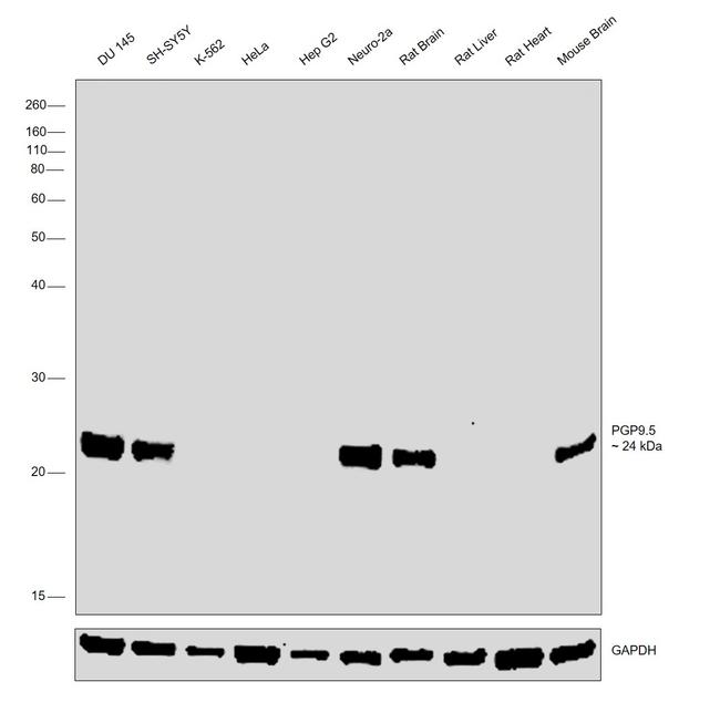 PGP9.5 Antibody in Western Blot (WB)