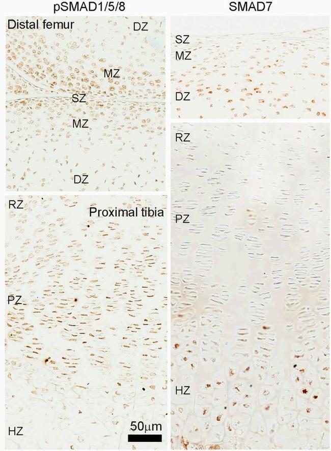 SMAD7 Antibody in Immunohistochemistry (IHC)