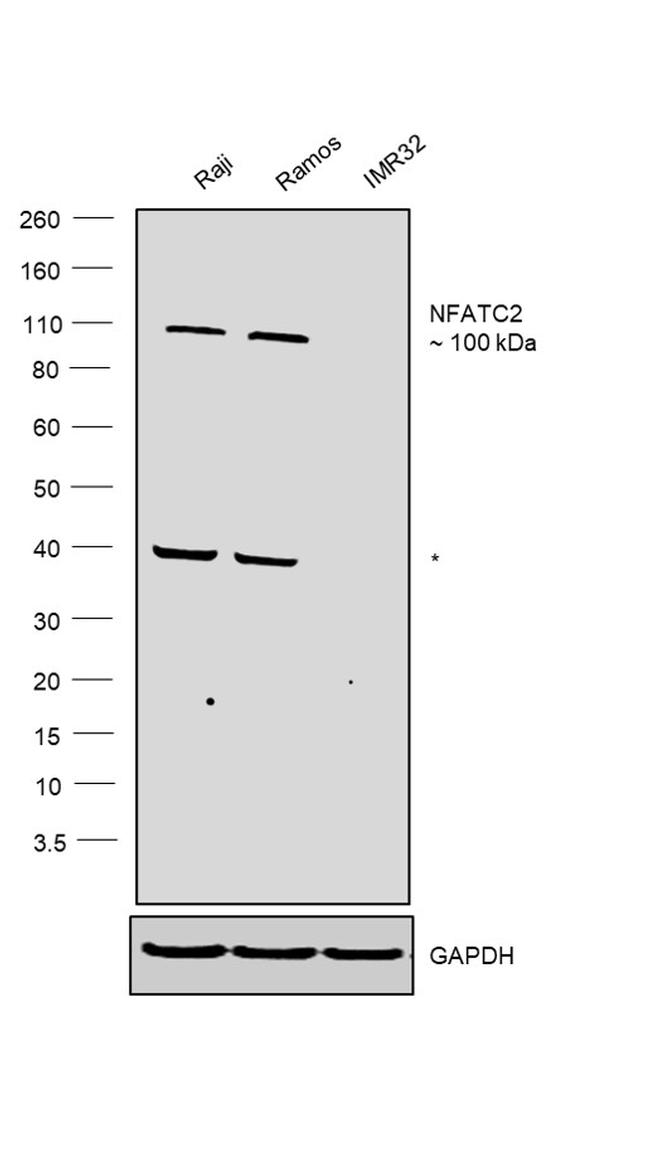 NFATC2 Antibody in Western Blot (WB)