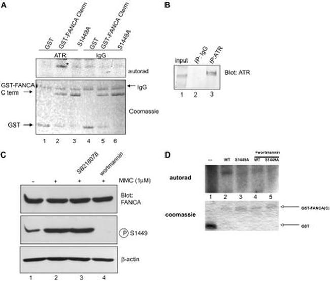 ATR Antibody in Western Blot, Immunoprecipitation (WB, IP)