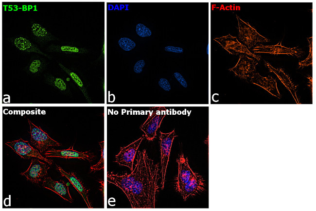 53BP1 Antibody in Immunocytochemistry (ICC/IF)