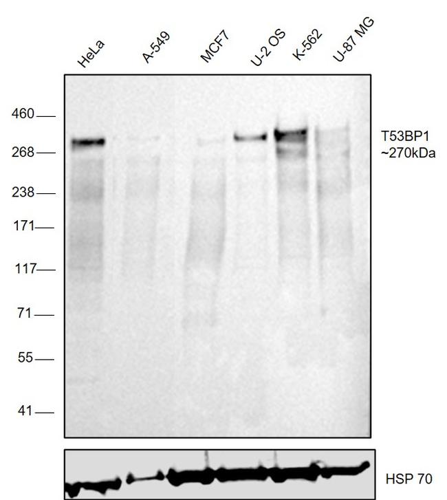 53BP1 Antibody in Western Blot (WB)