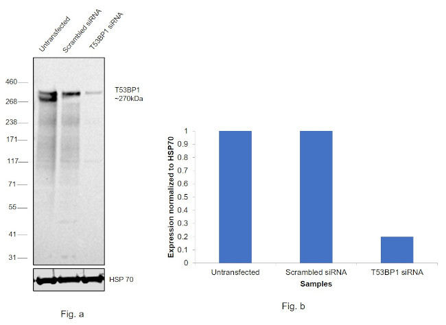 53BP1 Antibody