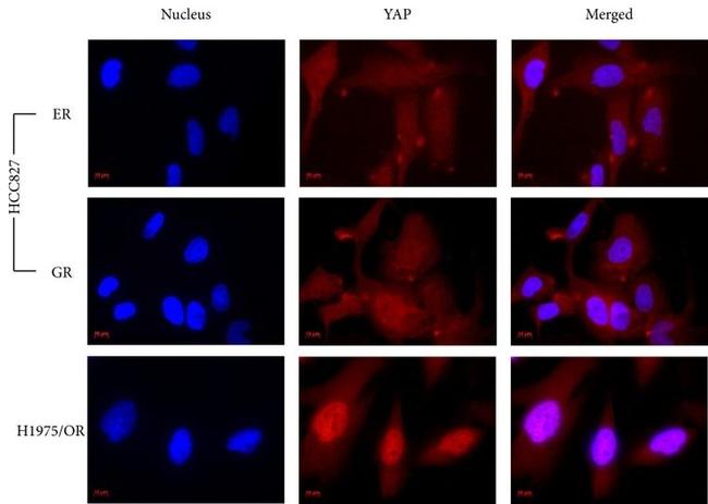 YAP1 Antibody in Immunocytochemistry (ICC/IF)