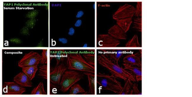 YAP1 Antibody in Immunocytochemistry (ICC/IF)