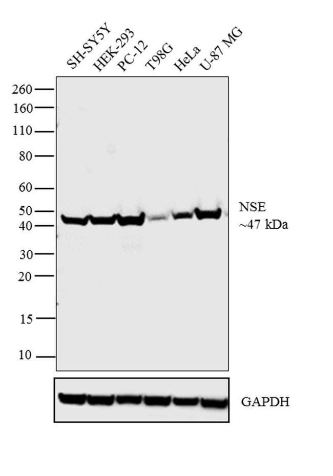 NSE Antibody in Western Blot (WB)