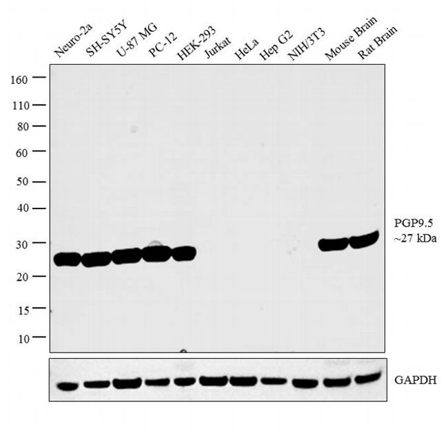 PGP9.5 Antibody in Western Blot (WB)