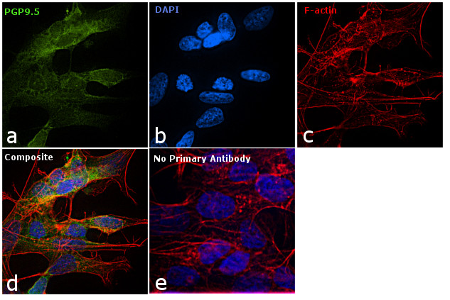 PGP9.5 Antibody in Immunocytochemistry (ICC/IF)