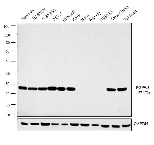 PGP9.5 Antibody in Western Blot (WB)