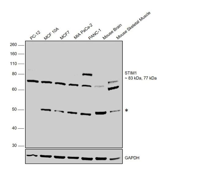 STIM1 Antibody in Western Blot (WB)