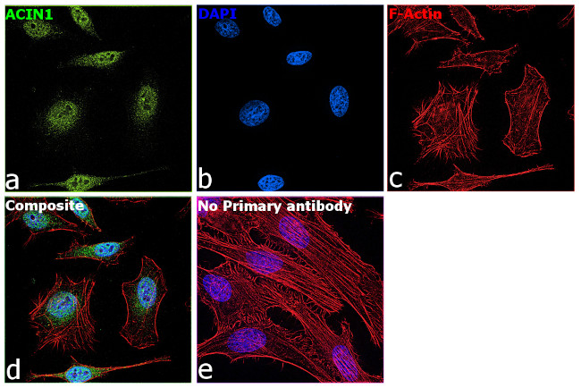 Acinus Antibody in Immunocytochemistry (ICC/IF)