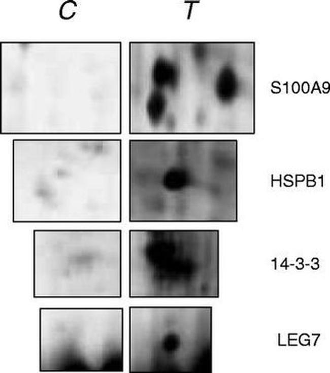 S100A9 Antibody in Western Blot (WB)