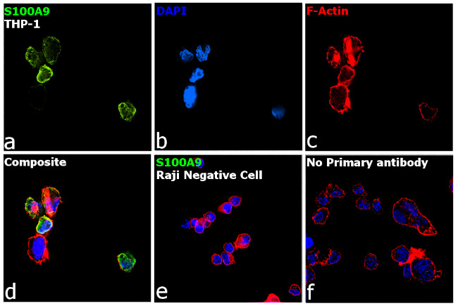 S100A9 Antibody in Immunocytochemistry (ICC/IF)