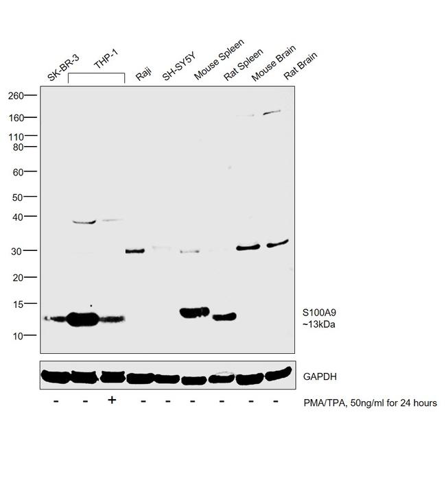 S100A9 Antibody in Western Blot (WB)