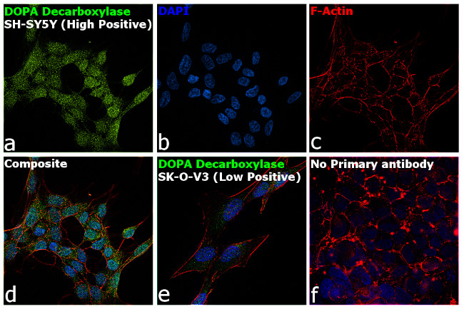 DOPA Decarboxylase Antibody