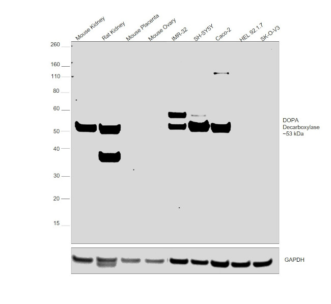 DOPA Decarboxylase Antibody