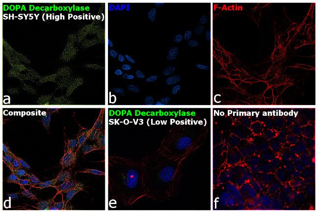 DOPA Decarboxylase Antibody