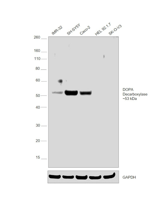 DOPA Decarboxylase Antibody