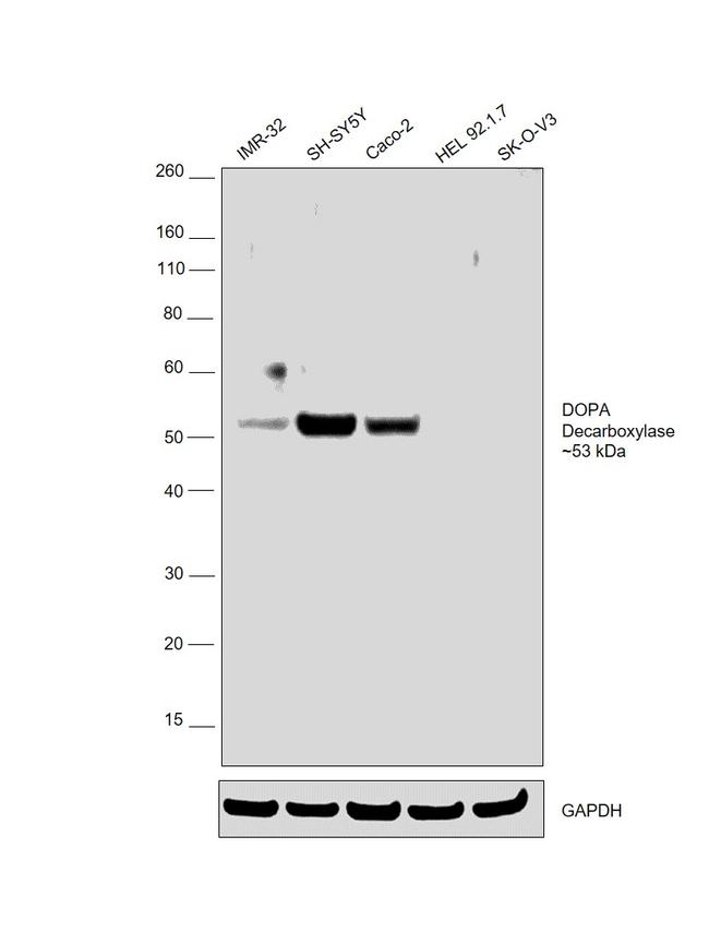 DOPA Decarboxylase Antibody in Western Blot (WB)