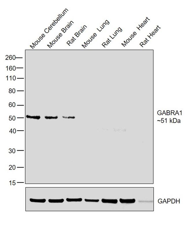 GABRA1 Antibody in Western Blot (WB)