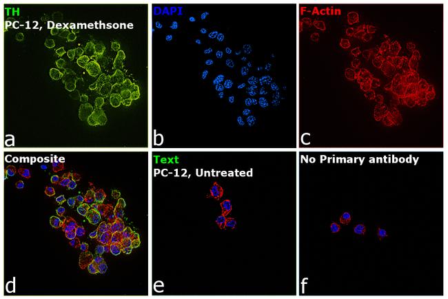 Tyrosine Hydroxylase Antibody