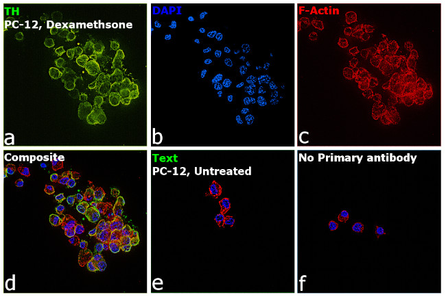 Tyrosine Hydroxylase Antibody in Immunocytochemistry (ICC/IF)