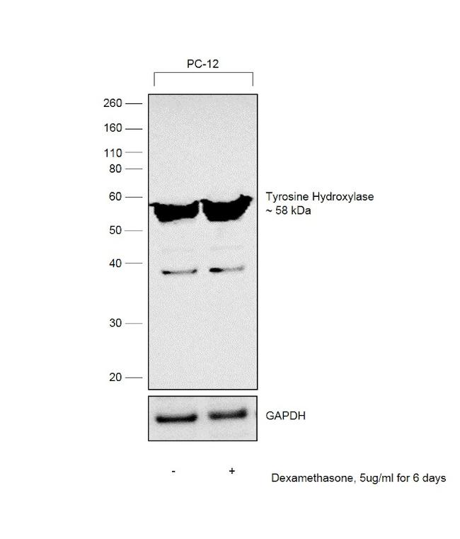 Tyrosine Hydroxylase Antibody in Western Blot (WB)