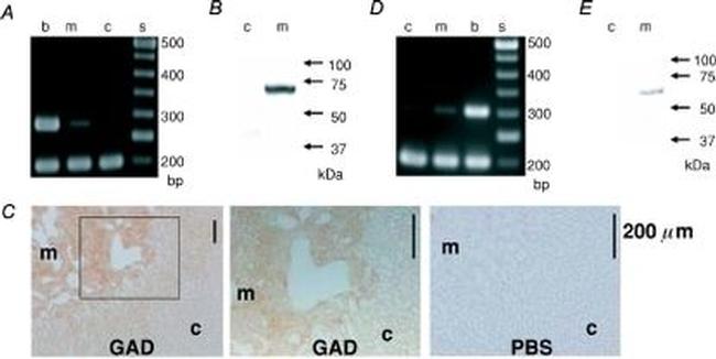 VGAT Antibody in Western Blot (WB)