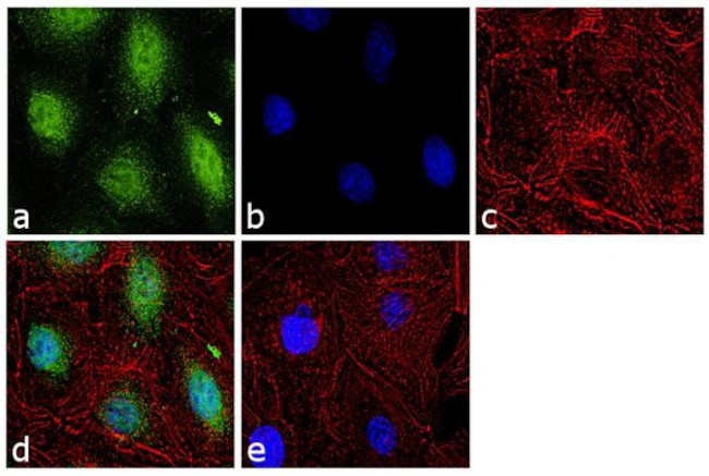 Glucocorticoid Receptor Antibody in Immunocytochemistry (ICC/IF)